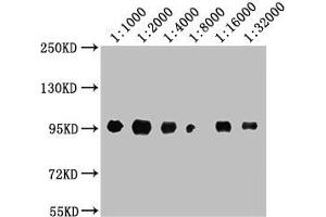 Western Blot Positive WB detected in: A549 whole cell lysate All lanes: CD44 antibody at 1:1000, 1:2000, 1:4000, 1:8000, 1:16000, 1:32000 Secondary Goat polyclonal to Mouse IgG at 1/10000 dilution Predicted band size: 82, 4, 78, 77, 81, 79, 75, 54,47, 40, 44, 33, 74, 76, 38, 16 kDa Observed band size: 95 kDa (CD44 antibody  (AA 21-220))