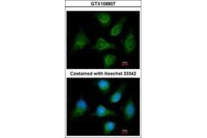 Image no. 2 for anti-Calcium Channel, Voltage-Dependent, beta 1 Subunit (CACNB1) (AA 360-523) antibody (ABIN467509) (CACNB1 antibody  (AA 360-523))