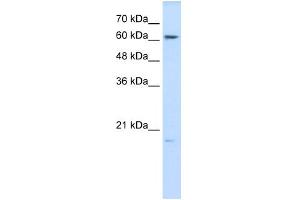 WB Suggested Anti-GPX3 Antibody Titration:  0. (GPX3 antibody  (N-Term))