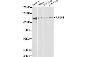Western blot analysis of extracts of various cell lines, using AP2A1 antibody. (alpha Adaptin antibody)