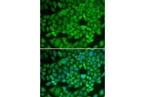 Immunofluorescence analysis of U2OS cells using NR0B1 antibody (ABIN5970870). (NR0B1 antibody)
