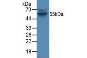 Figure. (Cyclin B1 antibody  (AA 239-433))