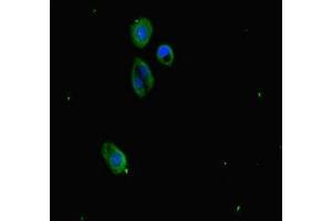 Immunofluorescence staining of HepG2 cells with ABIN7163811 at 1:333, counter-stained with DAPI. (SUZ12 antibody  (AA 131-305))