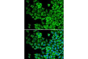 Immunofluorescence analysis of A549 cell using HCK antibody. (HCK antibody)
