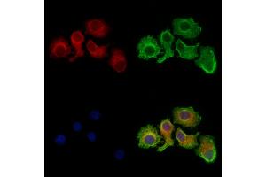 Citrate synthetase Antibody staining Hela cells by IF/ICC. (Citrate Synthetase (C-Term) antibody)