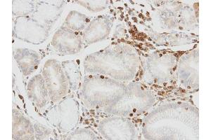 IHC-P Image Immunohistochemical analysis of paraffin-embedded human lymphocytes in gastric epithelium, using HCLS1, antibody at 1:100 dilution. (HCLS1 antibody  (C-Term))