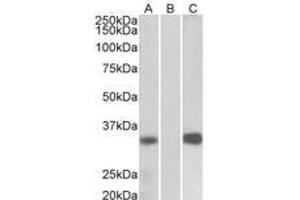 Image no. 1 for anti-Kv Channel Interacting Protein 3, Calsenilin (KCNIP3) (AA 21-31) antibody (ABIN1102701) (DREAM antibody  (AA 21-31))
