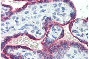 Human Placenta (formalin-fixed, paraffin-embedded) stained with ASH2L antibody ABIN462194 followed by biotinylated goat anti-rabbit IgG secondary antibody ABIN481713, alkaline phosphatase-streptavidin and chromogen. (ASH2L antibody  (AA 288-337))