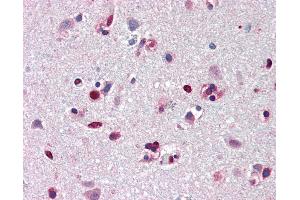 Immunohistochemistry (IHC) image for anti-Acidic (Leucine-Rich) Nuclear phosphoprotein 32 Family, Member A (ANP32A) (N-Term) antibody (ABIN461885)