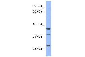 WB Suggested Anti-SOX21 Antibody Titration: 0. (SOX21 antibody  (Middle Region))