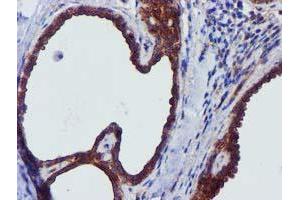 Immunohistochemical staining of paraffin-embedded Human breast tissue using anti-EPN2 mouse monoclonal antibody. (Epsin 2 antibody)