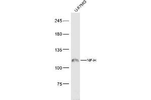 U-87MG lysates probed with NF-H Polyclonal Antibody, Unconjugated  at 1:300 dilution and 4˚C overnight incubation. (NEFH antibody  (AA 21-120))