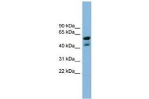Image no. 1 for anti-Protein Phosphatase Methylesterase 1 (PPME1) (N-Term) antibody (ABIN6742049) (PPME1 antibody  (N-Term))