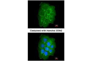 AP31081PU-N CAV2 antibody staining of Paraformaldehyde-Fixed A431 by Immunofluorescence at 1/200 dilution. (Caveolin 2 antibody  (AA 1-45))