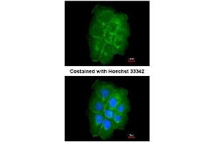AP31081PU-N CAV2 antibody staining of Paraformaldehyde-Fixed A431 by Immunofluorescence at 1/200 dilution.