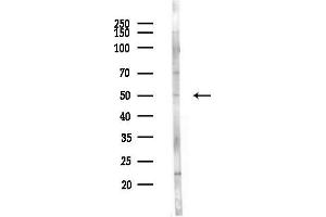 anti-Interleukin 6 Receptor (IL6R) (N-Term) antibody