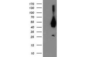 HEK293T cells were transfected with the pCMV6-ENTRY control (Left lane) or pCMV6-ENTRY ASCC1 (Right lane) cDNA for 48 hrs and lysed. (ASCC1 antibody)