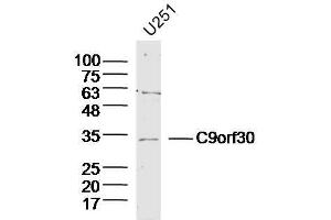 Lane 1: U251 lysates probed with C9orf30 Polyclonal Antibody, Unconjugated  at 1:300 overnight at 4˚C. (MSANTD3 antibody  (AA 1-100))