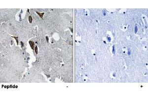 Immunohistochemistry analysis of paraffin-embedded human brain tissue using ELOVL5 polyclonal antibody . (ELOVL5 antibody)