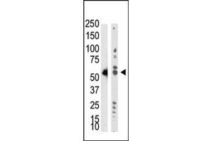 Western Blotting (WB) image for anti-tRNA Aspartic Acid Methyltransferase 1 (TRDMT1) (AA 300-400) antibody (ABIN356546) (Dnmt2 antibody  (AA 300-400))