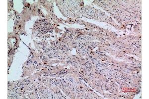 Immunohistochemistry (IHC) analysis of paraffin-embedded Human Uterus, antibody was diluted at 1:100. (RFC1 antibody  (C-Term))