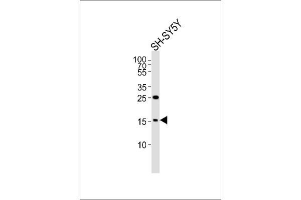 HMGN2 antibody