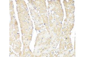 Immunohistochemistry of paraffin-embedded Mouse heart using ATP1B1 Polyclonal Antibody at dilution of 1:100 (40x lens). (ATP1B1 antibody)