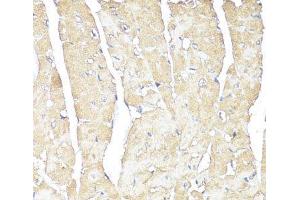 Immunohistochemistry of paraffin-embedded Mouse heart using ATP1B1 Polyclonal Antibody at dilution of 1:100 (40x lens). (ATP1B1 antibody)