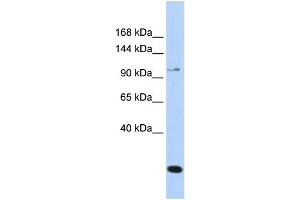 Western Blotting (WB) image for anti-Transient Receptor Potential Cation Channel, Subfamily C, Member 6 (TRPC6) (N-Term) antibody (ABIN2787801)