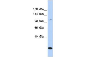 WB Suggested Anti-TRPC6 Antibody Titration: 0.