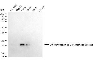 Western blotting analysis using O-6-methylguanine-DNA methyltransferase antibody (ABIN7799696).