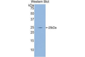 Western Blotting (WB) image for anti-Glutamate-Cysteine Ligase, Catalytic Subunit (GCLC) (AA 435-636) antibody (ABIN1858973) (GCLC antibody  (AA 435-636))