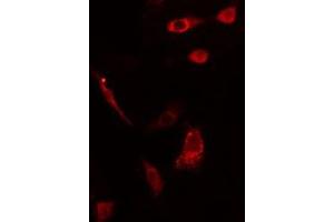 ABIN6275561 staining HepG2 cells by IF/ICC. (SH2D2A antibody  (C-Term))