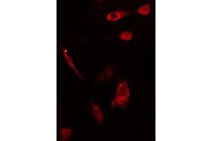 ABIN6275561 staining HepG2 cells by IF/ICC. (SH2D2A antibody  (C-Term))