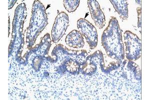 TRIM15 antibody  (AA 141-190)