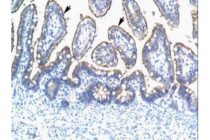 Image no. 2 for anti-Tripartite Motif Containing 15 (TRIM15) (AA 141-190) antibody (ABIN202591) (TRIM15 antibody  (AA 141-190))