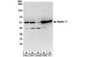 anti-Septin 11 (SEPT11) (AA 1-50) antibody