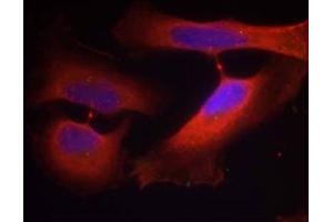 Immunofluorescence staining of methanol-fixed HeLa cells using Keratin 8 (Phospho-Ser74) Antibody (E011307, Red) (KRT8 antibody  (pSer74))