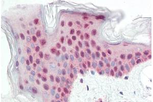 Human Skin: Formalin-Fixed, Paraffin-Embedded (FFPE) (ATG14 antibody  (Internal Region))