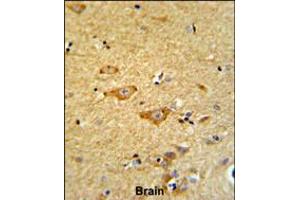 Formalin-fixed and paraffin-embedded human brain reacted with OMD Antibody , which was peroxidase-conjugated to the secondary antibody, followed by DAB staining.