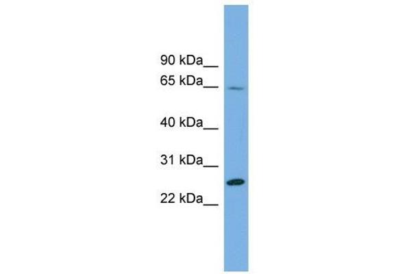 DDHD2 antibody  (N-Term)