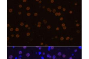 Immunofluorescence analysis of Mouse brain using MEF2C Polyclonal Antibody at dilution of 1:100 (40x lens). (MEF2C antibody)