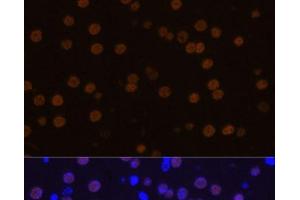 Immunofluorescence analysis of Mouse brain using MEF2C Polyclonal Antibody at dilution of 1:100 (40x lens).