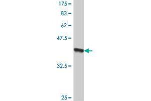 Western Blot detection against Immunogen (38. (RFT1 antibody  (AA 211-320))