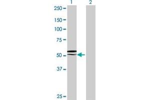 Western Blot analysis of GGT6 expression in transfected 293T cell line by GGT6 MaxPab polyclonal antibody. (gGT6 antibody  (AA 1-493))