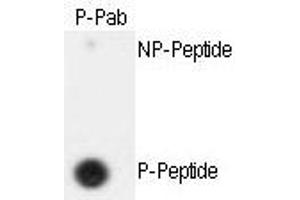 Image no. 2 for anti-Extra Spindle Poles Like 1 (ESPL1) (pSer1126) antibody (ABIN358223) (Separase antibody  (pSer1126))