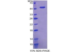SDS-PAGE analysis of Human ACVR1 Protein. (ACVR1 Protein)