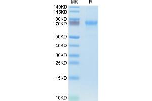 CXCL16 Protein (AA 30-205) (Fc Tag)