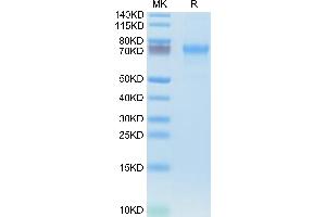 Human CXCL16 on Tris-Bis PAGE under reduced condition. (CXCL16 Protein (AA 30-205) (Fc Tag))