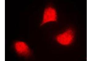 Immunofluorescent analysis of MKK4 (pT261) staining in NIH3T3 cells. (MAP2K4 antibody  (pSer261))